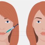 How to Get the Best Results from Your Botox Treatment