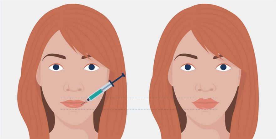 How to Get the Best Results from Your Botox Treatment