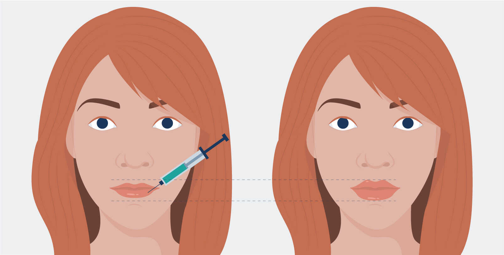 How to Get the Best Results from Your Botox Treatment